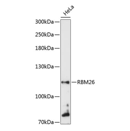 Western Blot - Anti-RBM26 Antibody (A87933) - Antibodies.com