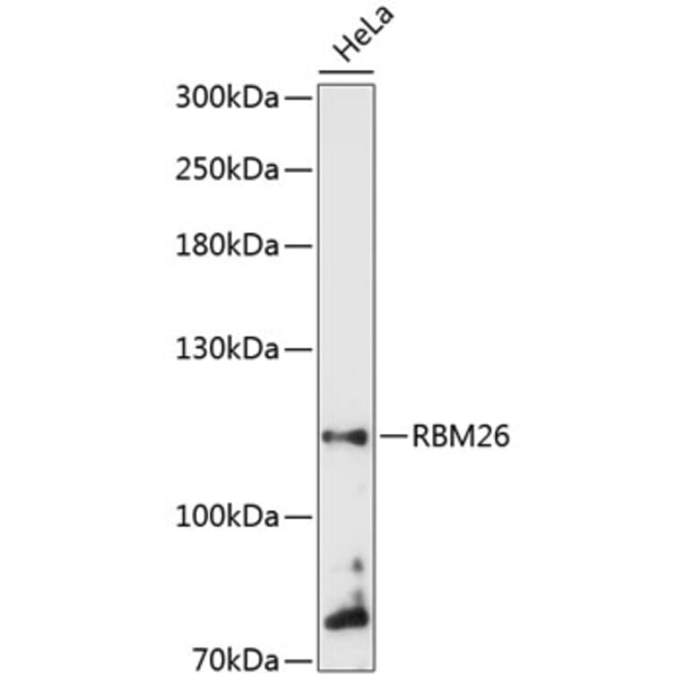 Western Blot - Anti-RBM26 Antibody (A87933) - Antibodies.com