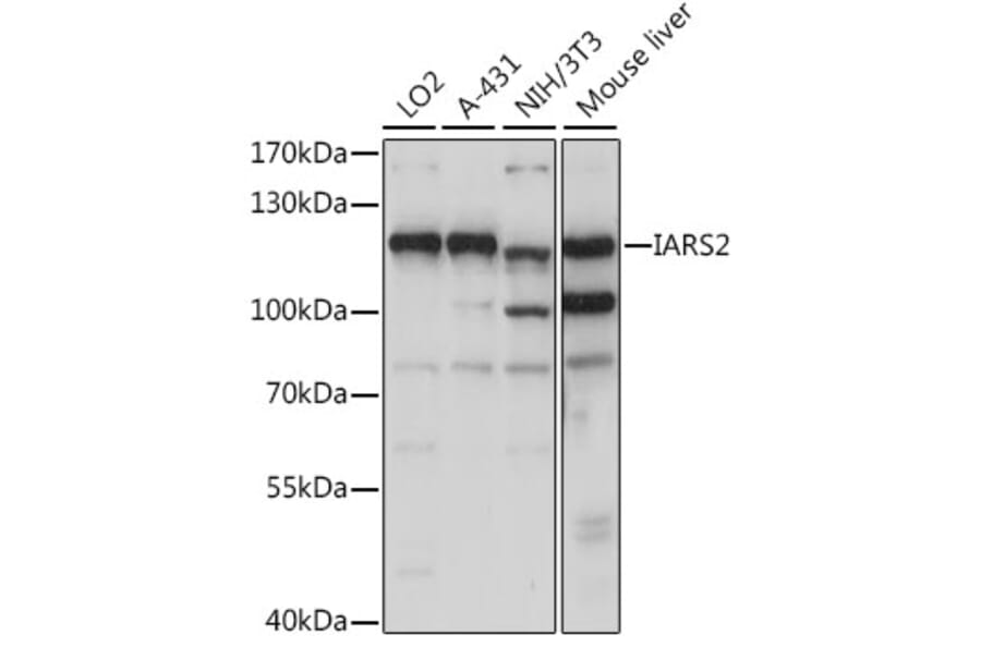 Western Blot - Anti-IARS2 Antibody (A87934) - Antibodies.com