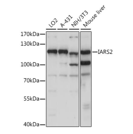 Western Blot - Anti-IARS2 Antibody (A87934) - Antibodies.com