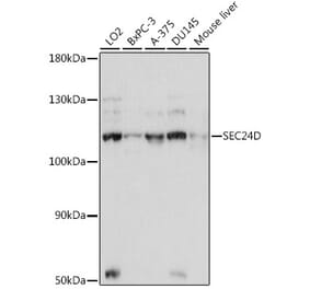 Western Blot - Anti-SEC24D Antibody (A87935) - Antibodies.com