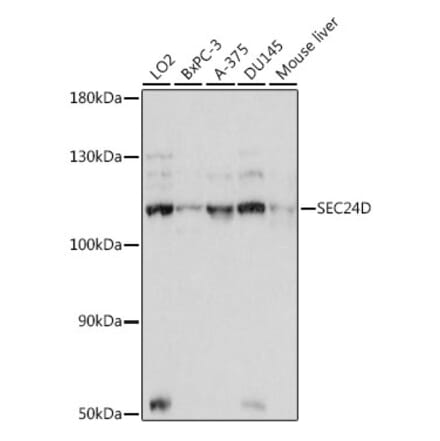 Western Blot - Anti-SEC24D Antibody (A87935) - Antibodies.com