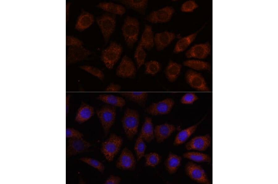 Immunofluorescence - Anti-SEC24D Antibody (A87935) - Antibodies.com