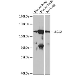 Western Blot - Anti-LLGL2 Antibody (A87936) - Antibodies.com