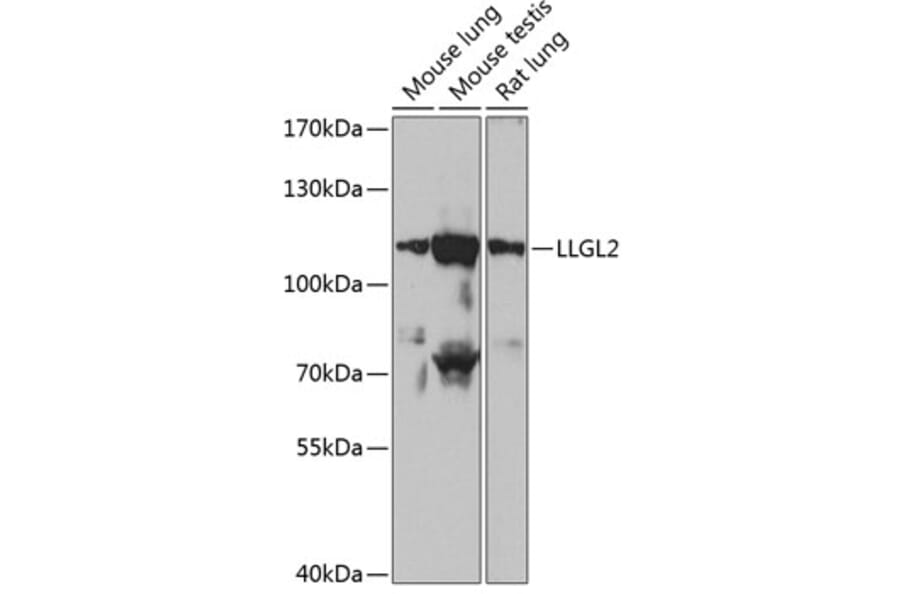 Western Blot - Anti-LLGL2 Antibody (A87936) - Antibodies.com