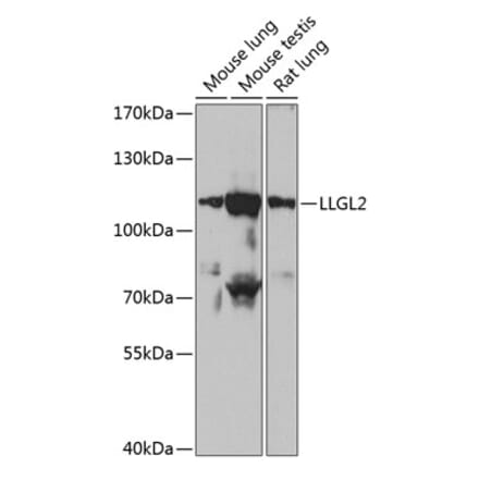 Western Blot - Anti-LLGL2 Antibody (A87936) - Antibodies.com