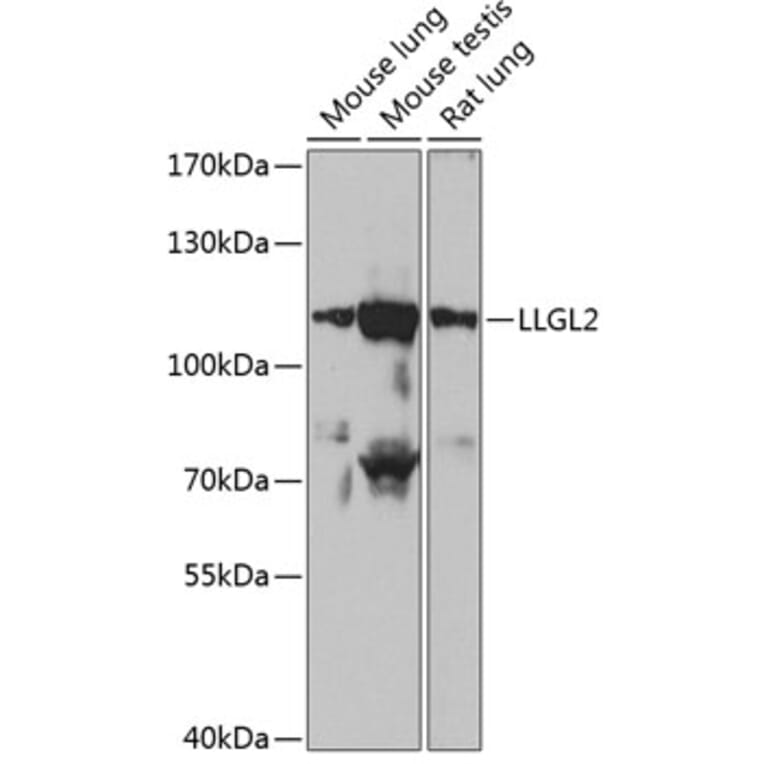 Western Blot - Anti-LLGL2 Antibody (A87936) - Antibodies.com