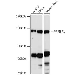 Western Blot - Anti-PPFIBP1 Antibody (A87937) - Antibodies.com