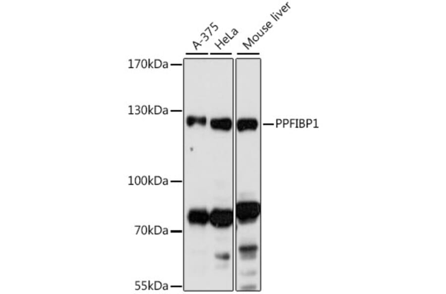 Western Blot - Anti-PPFIBP1 Antibody (A87937) - Antibodies.com