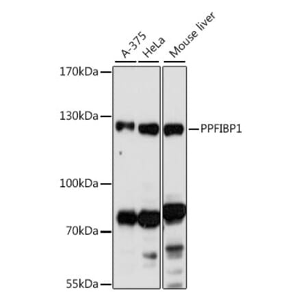 Western Blot - Anti-PPFIBP1 Antibody (A87937) - Antibodies.com