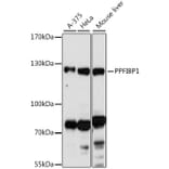 Western Blot - Anti-PPFIBP1 Antibody (A87937) - Antibodies.com