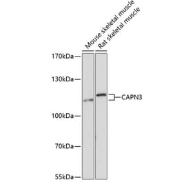 Western Blot - Anti-Calpain 3 Antibody (A87938) - Antibodies.com