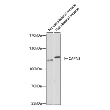 Western Blot - Anti-Calpain 3 Antibody (A87938) - Antibodies.com