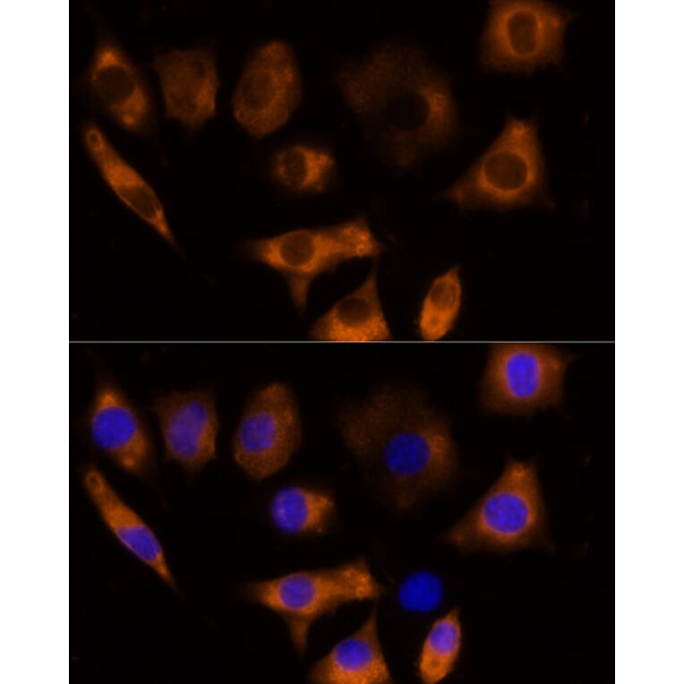 Immunofluorescence - Anti-Calpain 3 Antibody (A87938) - Antibodies.com