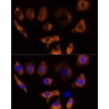 Immunofluorescence - Anti-Calpain 3 Antibody (A87938) - Antibodies.com