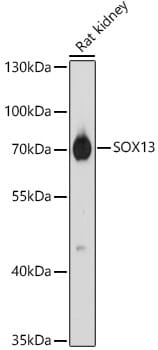 Western blot analysis of extracts of various cell lines, using Anti-SOX13 Antibody (A15759) at 1:1,000 dilution.
Secondary antibody: Goat Anti-Rabbit IgG (H+L) (HRP) (AS014) at 1:10,000 dilution.
Lysates / proteins: 25µg per lane.
Blocking buffer: 3% non-fat dry milk in TBST.
Detection: ECL Basic Kit (RM00020).
Exposure time: 30s.