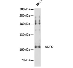 Western Blot - Anti-TMEM16B Antibody (A87940) - Antibodies.com