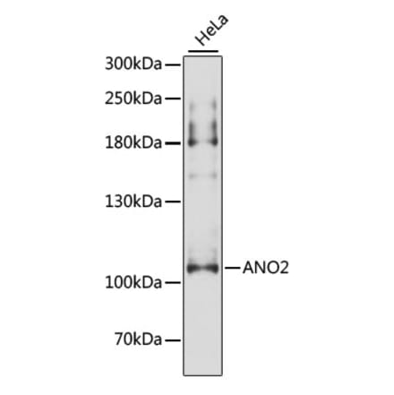 Western Blot - Anti-TMEM16B Antibody (A87940) - Antibodies.com