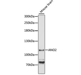 Western Blot - Anti-TMEM16B Antibody (A87941) - Antibodies.com