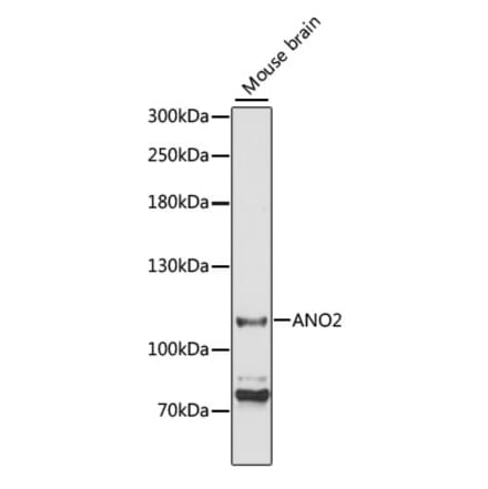 Western Blot - Anti-TMEM16B Antibody (A87941) - Antibodies.com