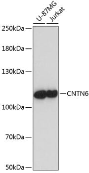 Western blot analysis of extracts of various cell lines, using Anti-CNTN6 Antibody (A14275) at 1:1,000 dilution.
Secondary antibody: Goat Anti-Rabbit IgG (H+L) (HRP) (AS014) at 1:10,000 dilution.
Lysates / proteins: 25µg per lane.
Blocking buffer: 3% non-fat dry milk in TBST.
Detection: ECL Enhanced Kit (RM00021).
Exposure time: 60s.