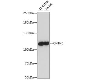 Western Blot - Anti-Contactin 6 Antibody (A87942) - Antibodies.com