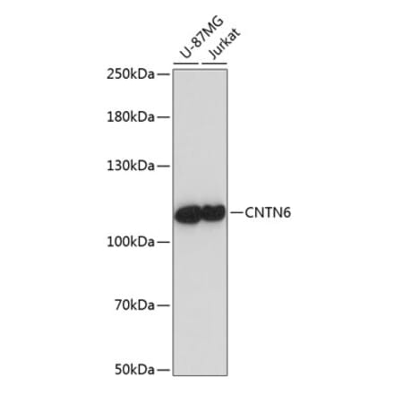 Western Blot - Anti-Contactin 6 Antibody (A87942) - Antibodies.com