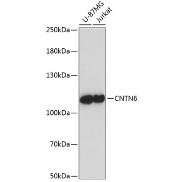 Western Blot - Anti-Contactin 6 Antibody (A87942) - Antibodies.com