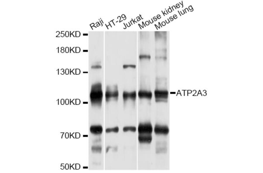 Western Blot - Anti-ATP2A3 Antibody (A14232) - Antibodies.com