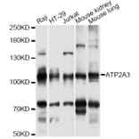 Western Blot - Anti-ATP2A3 Antibody (A14232) - Antibodies.com