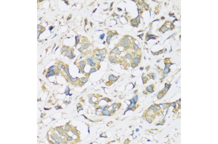 Immunohistochemistry - Anti-ATP2A3 Antibody (A14232) - Antibodies.com