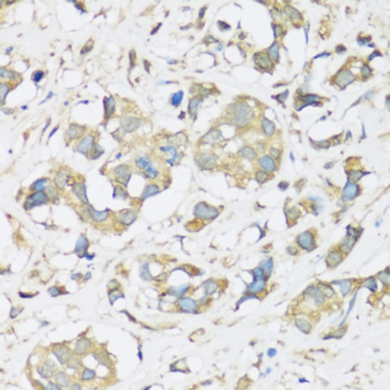 Immunohistochemistry - Anti-ATP2A3 Antibody (A14232) - Antibodies.com