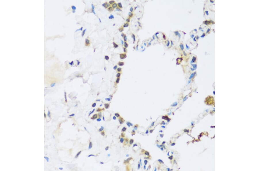 Immunohistochemistry - Anti-ATP2A3 Antibody (A14232) - Antibodies.com