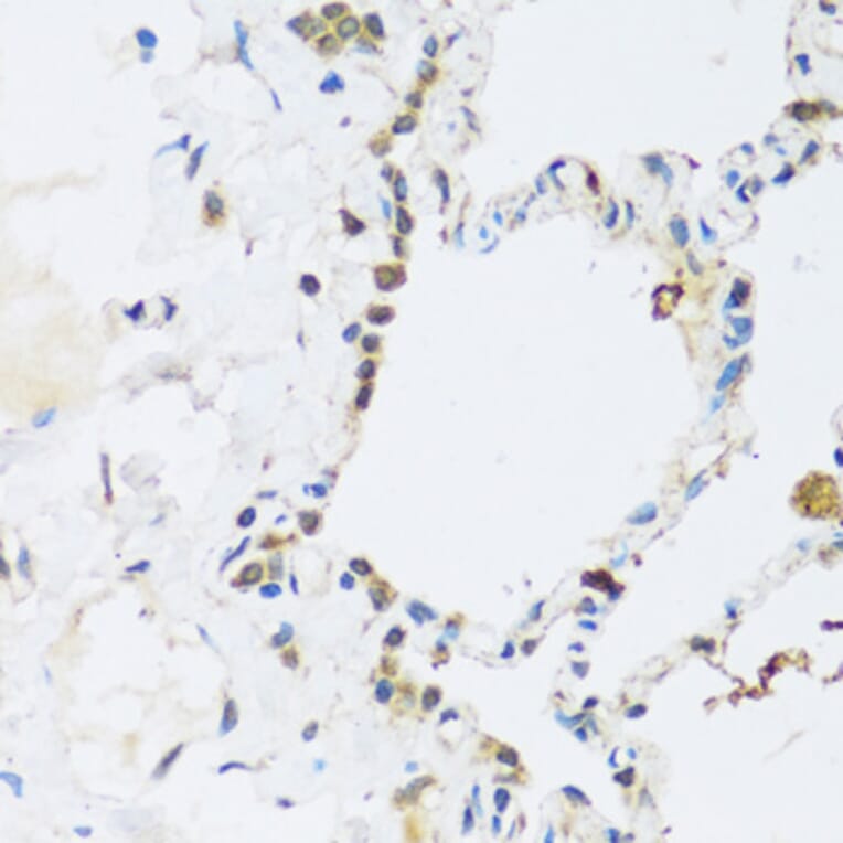 Immunohistochemistry - Anti-ATP2A3 Antibody (A14232) - Antibodies.com
