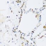 Immunohistochemistry - Anti-ATP2A3 Antibody (A14232) - Antibodies.com