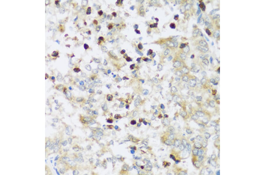 Immunohistochemistry - Anti-ATP2A3 Antibody (A14232) - Antibodies.com