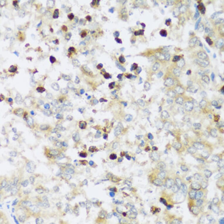 Immunohistochemistry - Anti-ATP2A3 Antibody (A14232) - Antibodies.com