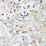 Immunohistochemistry - Anti-ATP2A3 Antibody (A14232) - Antibodies.com