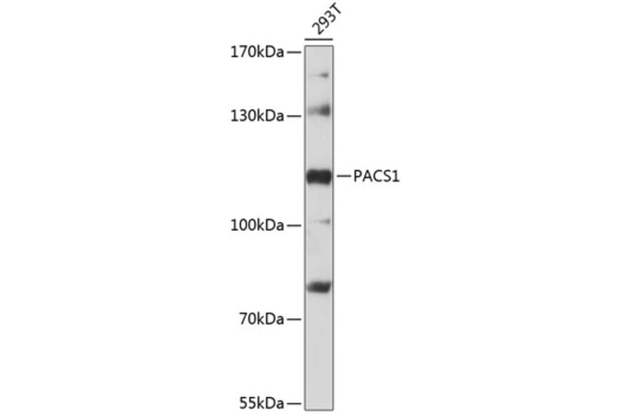Western Blot - Anti-PACS1 Antibody (A87945) - Antibodies.com