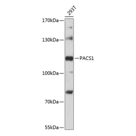 Western Blot - Anti-PACS1 Antibody (A87945) - Antibodies.com