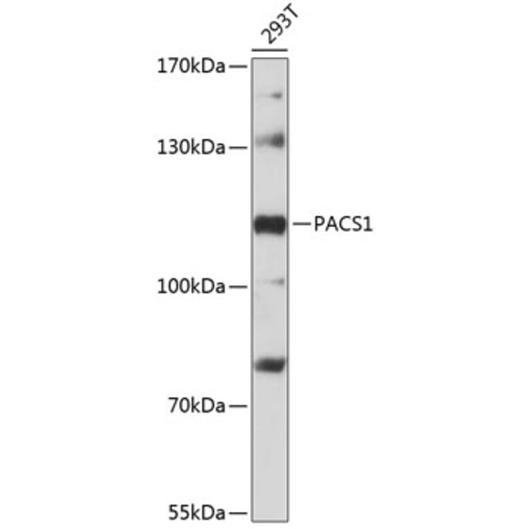 Western Blot - Anti-PACS1 Antibody (A87945) - Antibodies.com