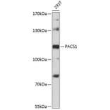 Western Blot - Anti-PACS1 Antibody (A87945) - Antibodies.com