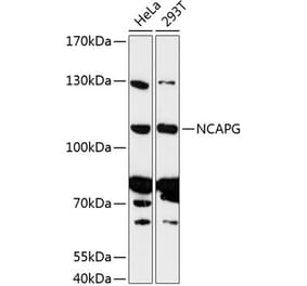 Western Blot - Anti-NCAPG Antibody (A87946) - Antibodies.com