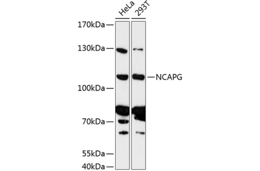 Western Blot - Anti-NCAPG Antibody (A87946) - Antibodies.com