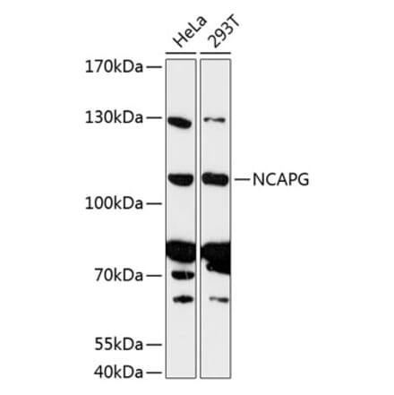 Western Blot - Anti-NCAPG Antibody (A87946) - Antibodies.com