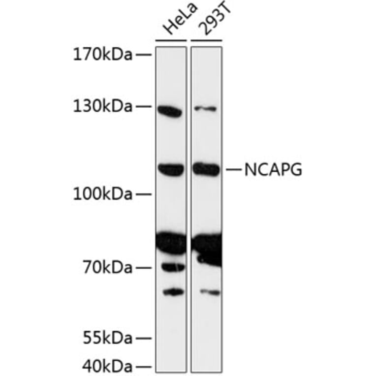 Western Blot - Anti-NCAPG Antibody (A87946) - Antibodies.com