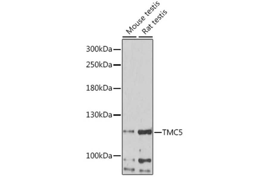 Western Blot - Anti-TMC5 Antibody (A87947) - Antibodies.com