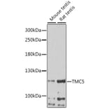Western Blot - Anti-TMC5 Antibody (A87947) - Antibodies.com