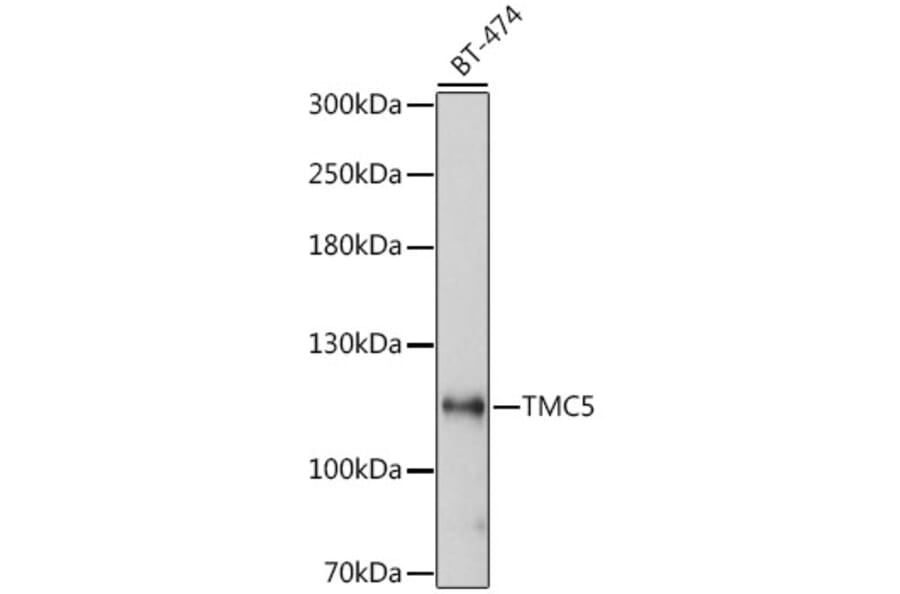 Western Blot - Anti-TMC5 Antibody (A87948) - Antibodies.com