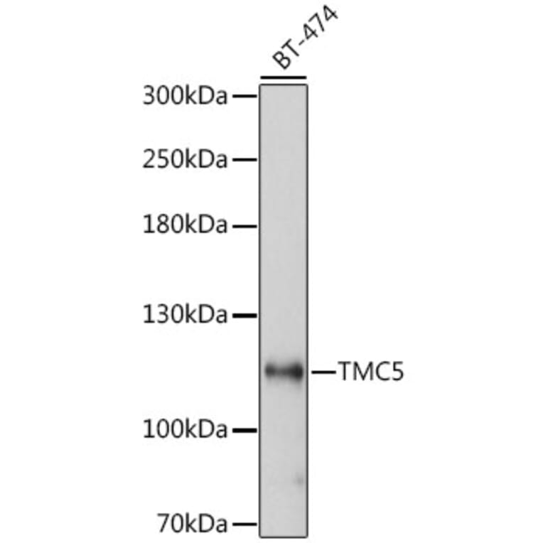Western Blot - Anti-TMC5 Antibody (A87948) - Antibodies.com